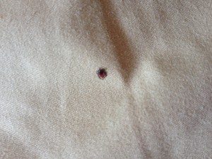 tick on my bed
